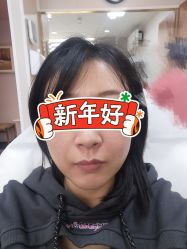 体验前-联合丽格·张菡丽格医疗美容