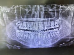 -圣贝口腔(海淀店)