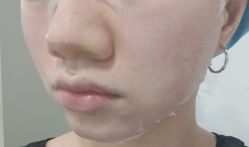 -成都西区医院整形美容