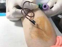 -杭州市第一人民医院(湖滨院区)