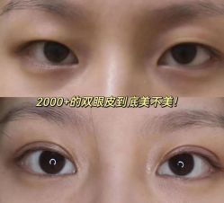 -温州伯思立医院