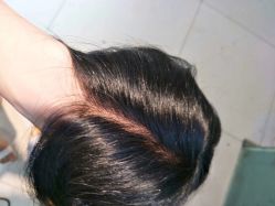 点击看大图 -发饰美男士增发补发假发定制店