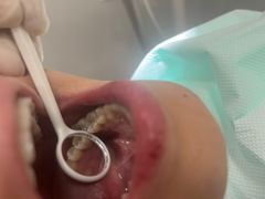 -宁波壹加壹口腔·矫正种植中心