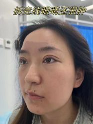 -素美医疗美容·西南眼鼻整形·修复基地