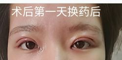 -八大处整形