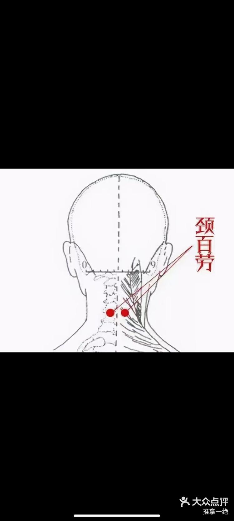 颈百劳穴具有滋补肺阴