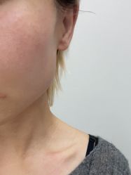 体验后-BR光电保养