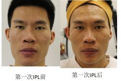 -丰联丽格医疗美容·联合丽格眼整形中心