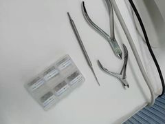 -Andrew指甲专科灰指甲·甲沟炎矫正·3D步态矫形鞋垫定制(上海法华镇路旗舰店)