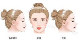 -北京米扬丽格医疗美容·联合丽格鼻整形中心