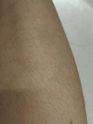 -MUSES专业脱毛比基尼サロン日式连锁
