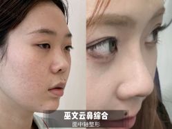 -北京米扬丽格医疗美容·联合丽格鼻整形中心