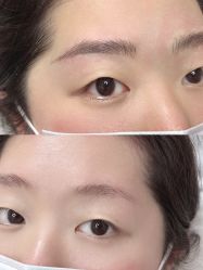 -德绣·机器野生眉发际线·美瞳线半永久