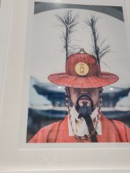 点击看大图 体验后-上海首尔丽格医疗美容医院
