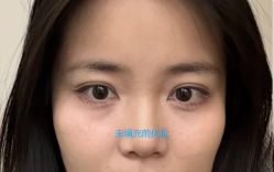 -天津健丽·去眼袋医疗美容机构