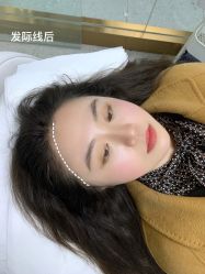 -OnFaer.纹眉半永久无创洗眉