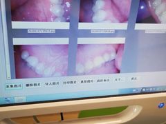 -团圆口腔·种植中心(锦江院区)