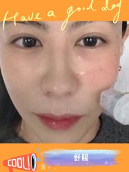 -广州健丽·去眼袋医疗美容机构