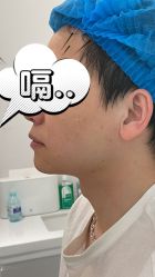 体验后-纯粹医美