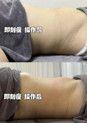 -Lily纤美·科技减脂中心