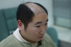 -发饰美男士增发补发假发定制店