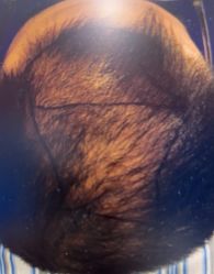 -雍禾植发全国连锁