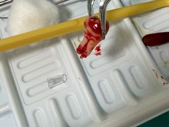 -上海仁爱医院口腔科 · 种植