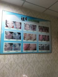 -苗方清颜专业祛痘连锁机构