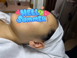 -皇族养心堂·净痘·修敏·御颜