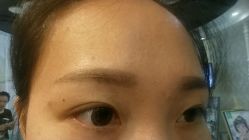android_upload_pic-依萱绮医疗美容