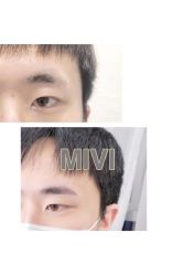 -MIVI半永久纹眉纹绣