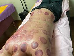 -沈师傅盲人按摩工作室(密三小区店)