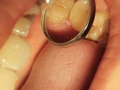 -泰康拜博口腔(世博园乐尔店)