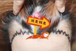 -大麦微针植发全国连锁