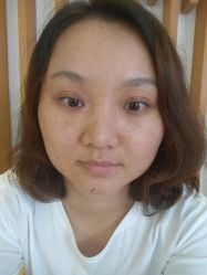 体验前-深圳美莱医疗美容医院