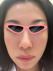 体验后-北京米扬丽格医疗美容·联合丽格鼻整形中心