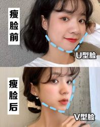 -上海漾颜医疗美容