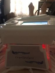 -肥三针腧穴瘦身馆