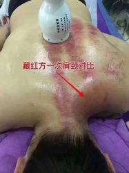 -久香宫美容中心西米优瘦身店