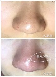 光SPA皮肤深层水养-光SPA科技美肤