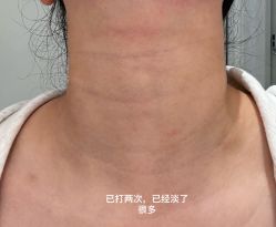 -深圳米兰柏羽医疗美容医院