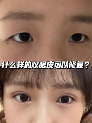 -深圳艺星医疗美容医院