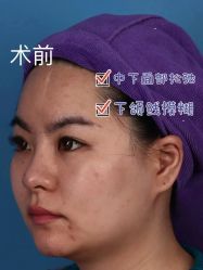 -广州美莱医疗美容医院