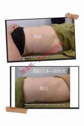 -骄阳兰多产后修复(徐东旗舰店)