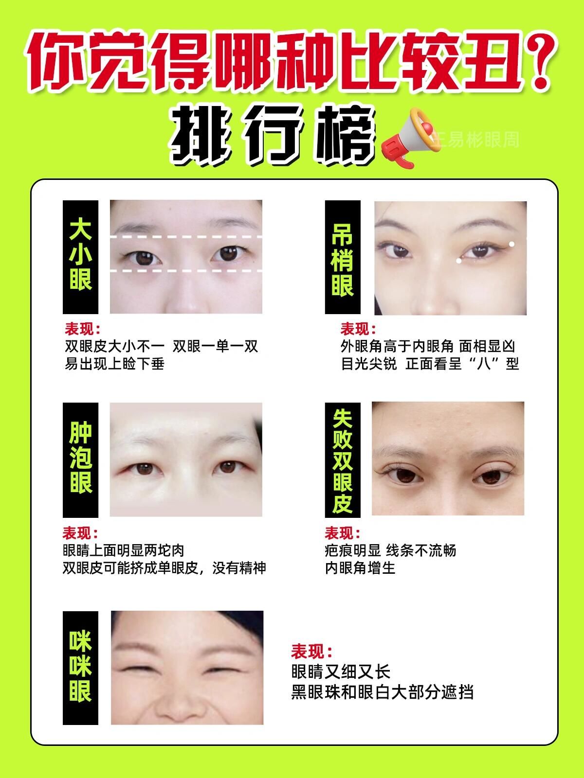 双,易出现上睑下垂
2⃣️吊梢眼
外眼角高于内眼角,面相显凶