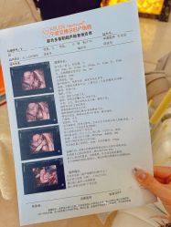 -艾博尔医院