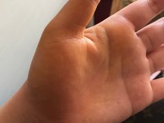 -御筋堂正骨推拿(星源国际店)