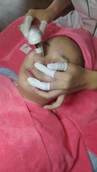 -成都苗方清颜专业祛痘