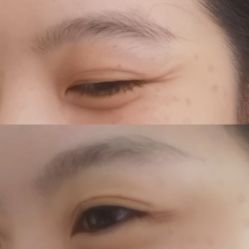体验前-杭州医巢医疗美容