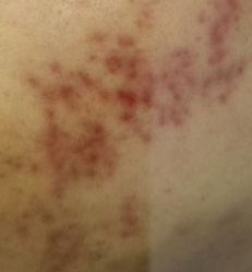 -蕾特恩专业祛痘·皮肤管理